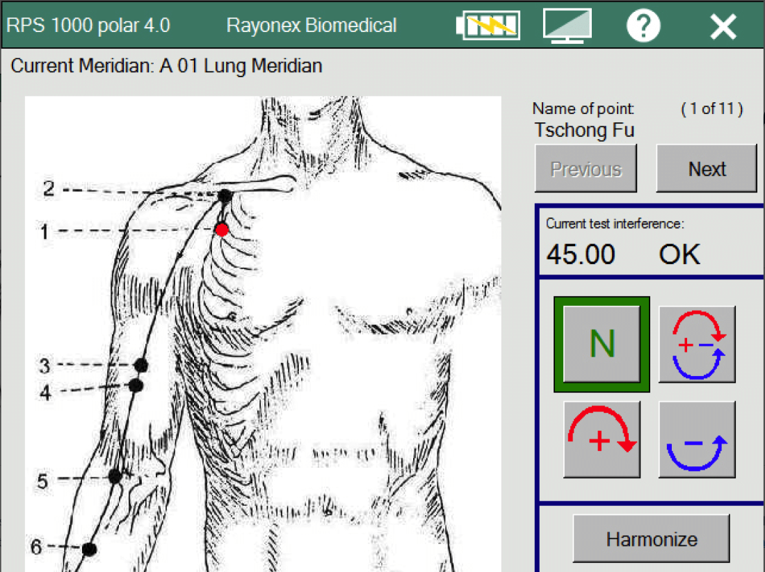 Rayoscan acupuncture analysis Acupuncture Oscilliation Therapy